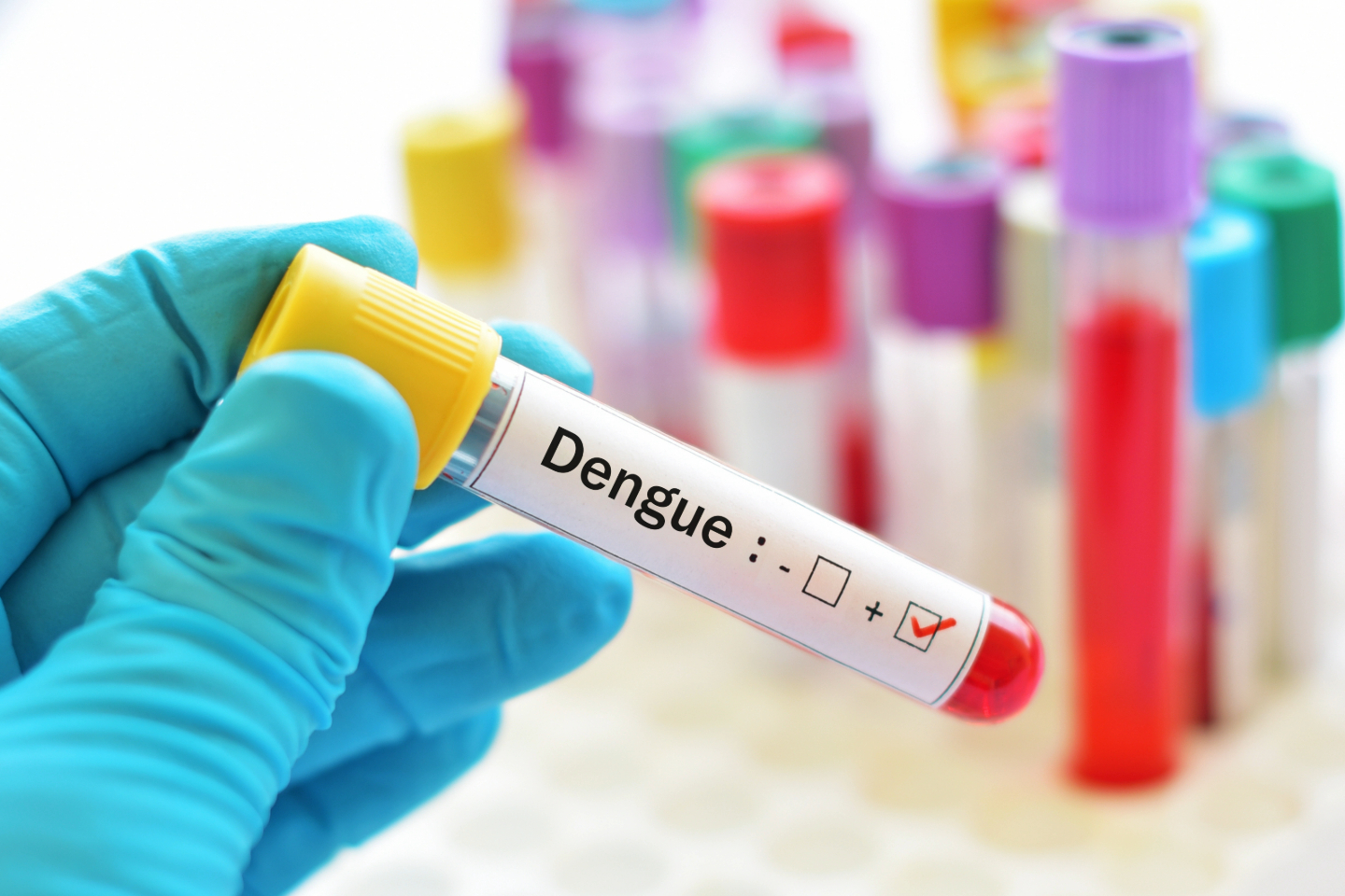 Dengue Fever