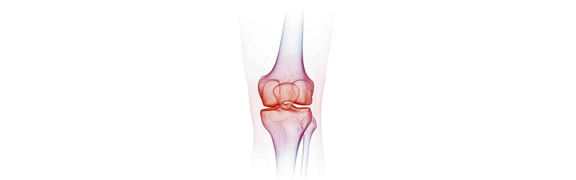 FREEDOM Total Knee System for Knee Replacement