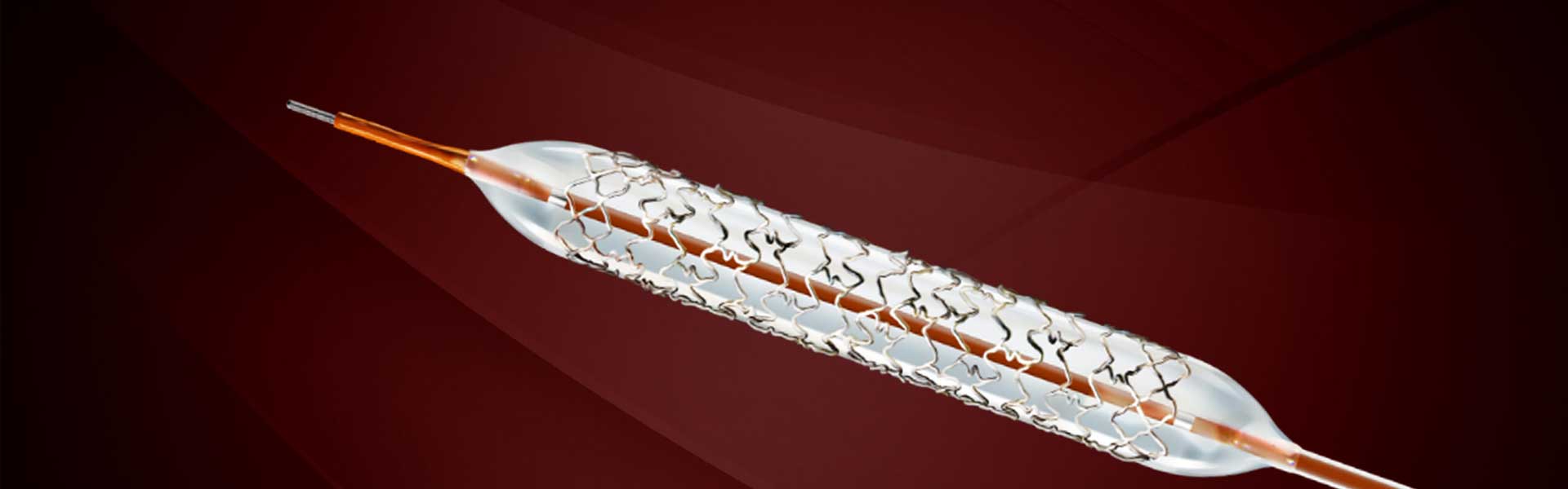 How to choose the right coronary stent?