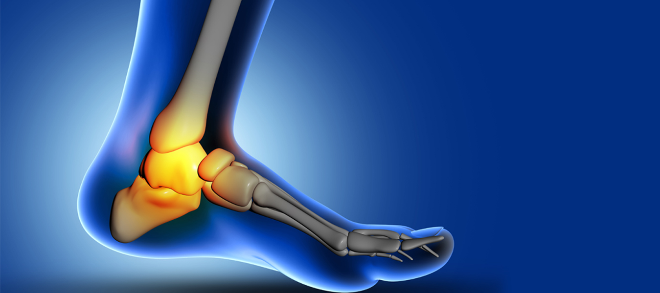 Soft Tissue Injuries