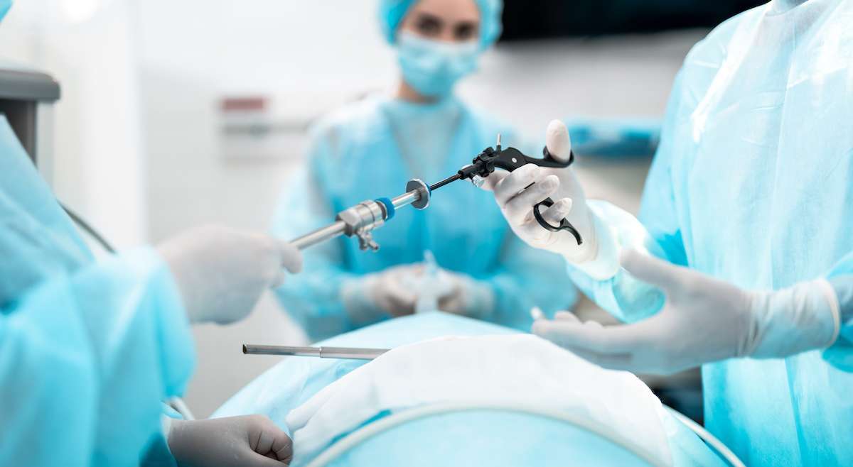 Open Vs Laparoscopic Surgery: Which is the Best Procedure