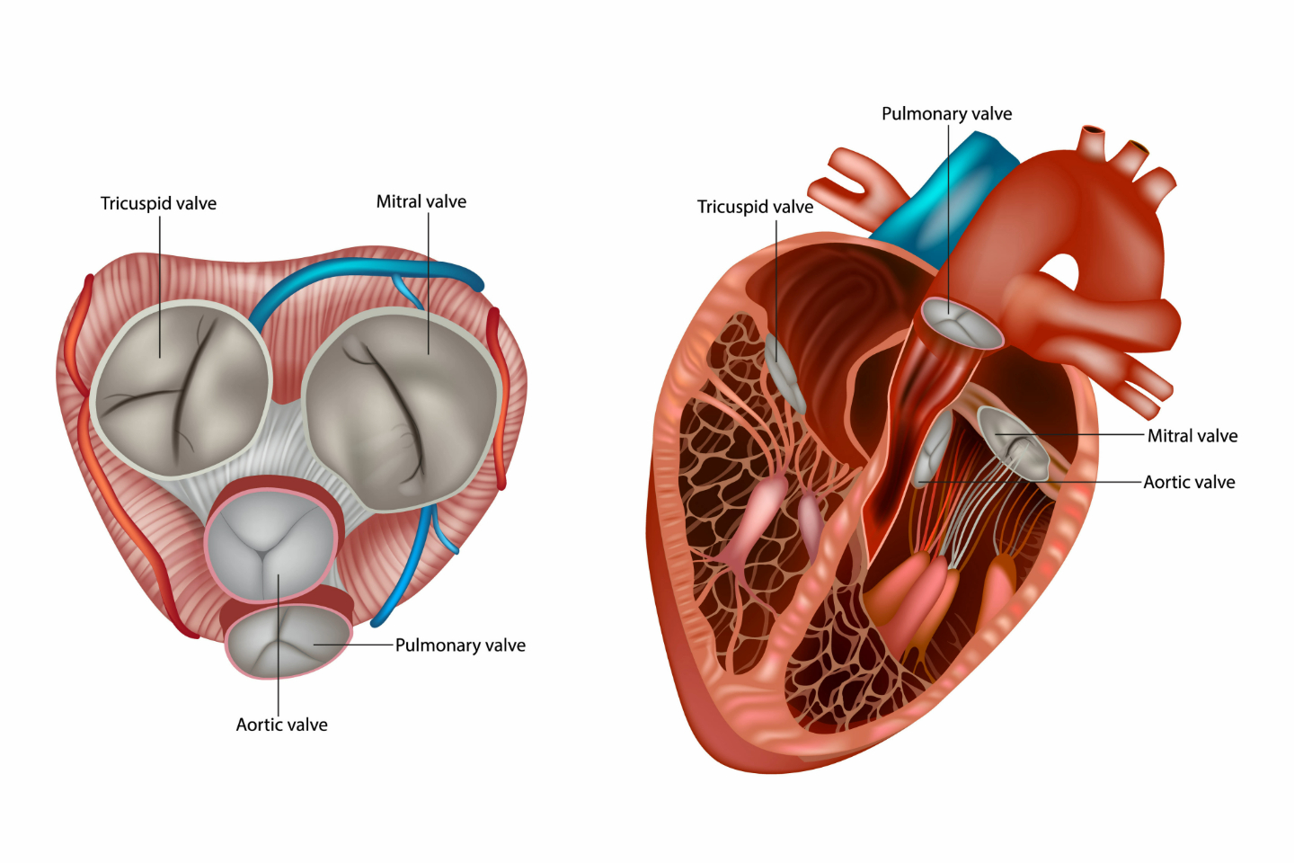 Aortic Stenosis and Aortic Regurgitation