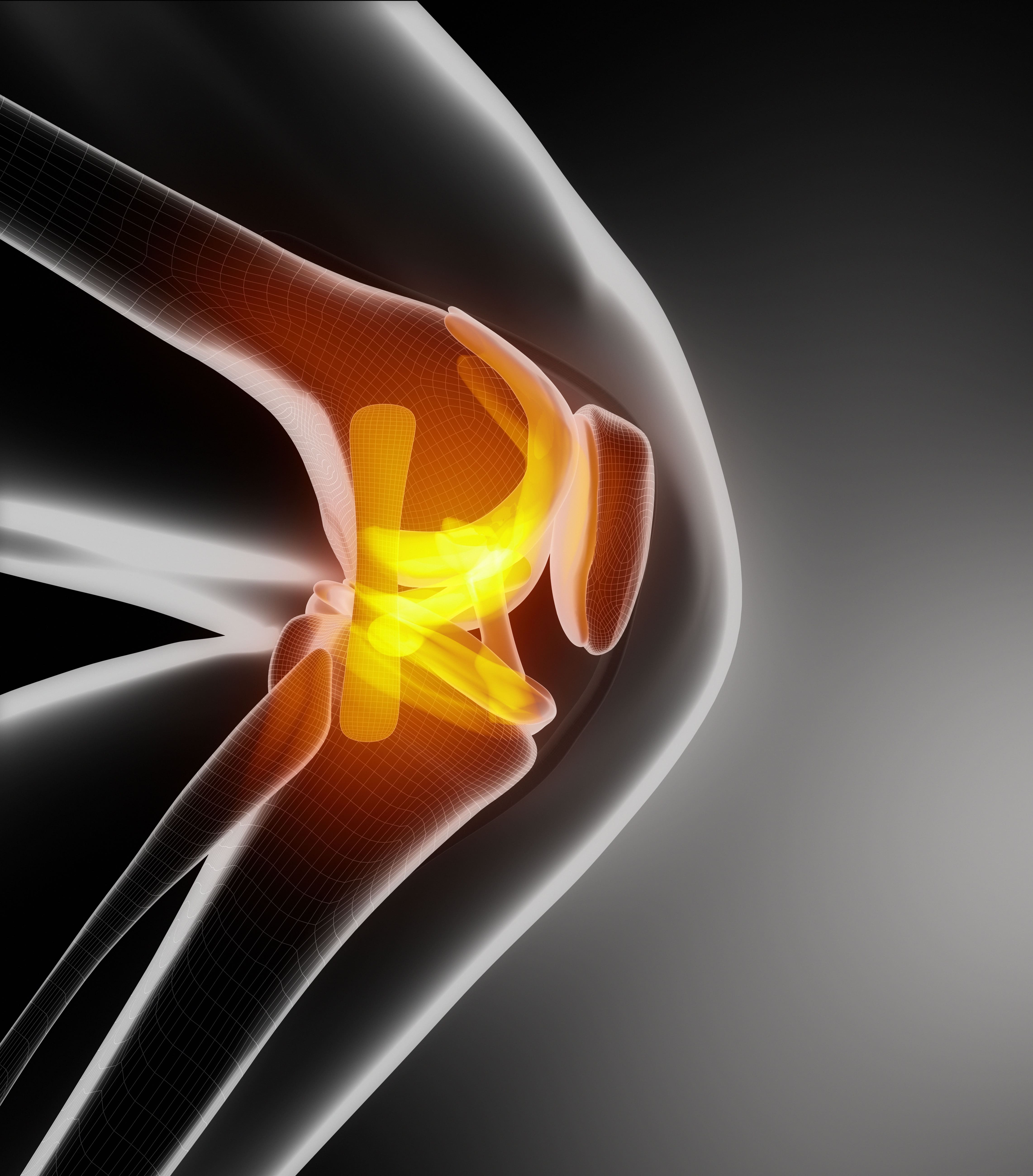 An Overview of Patellar Injuries