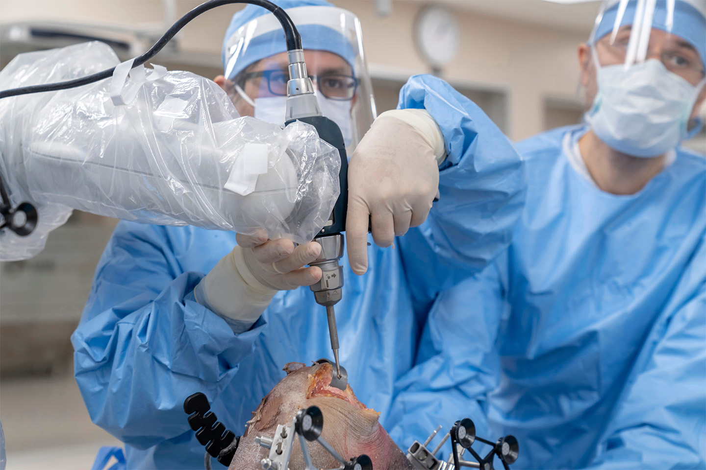  Revolutionizing Knee Replacement Surgery: