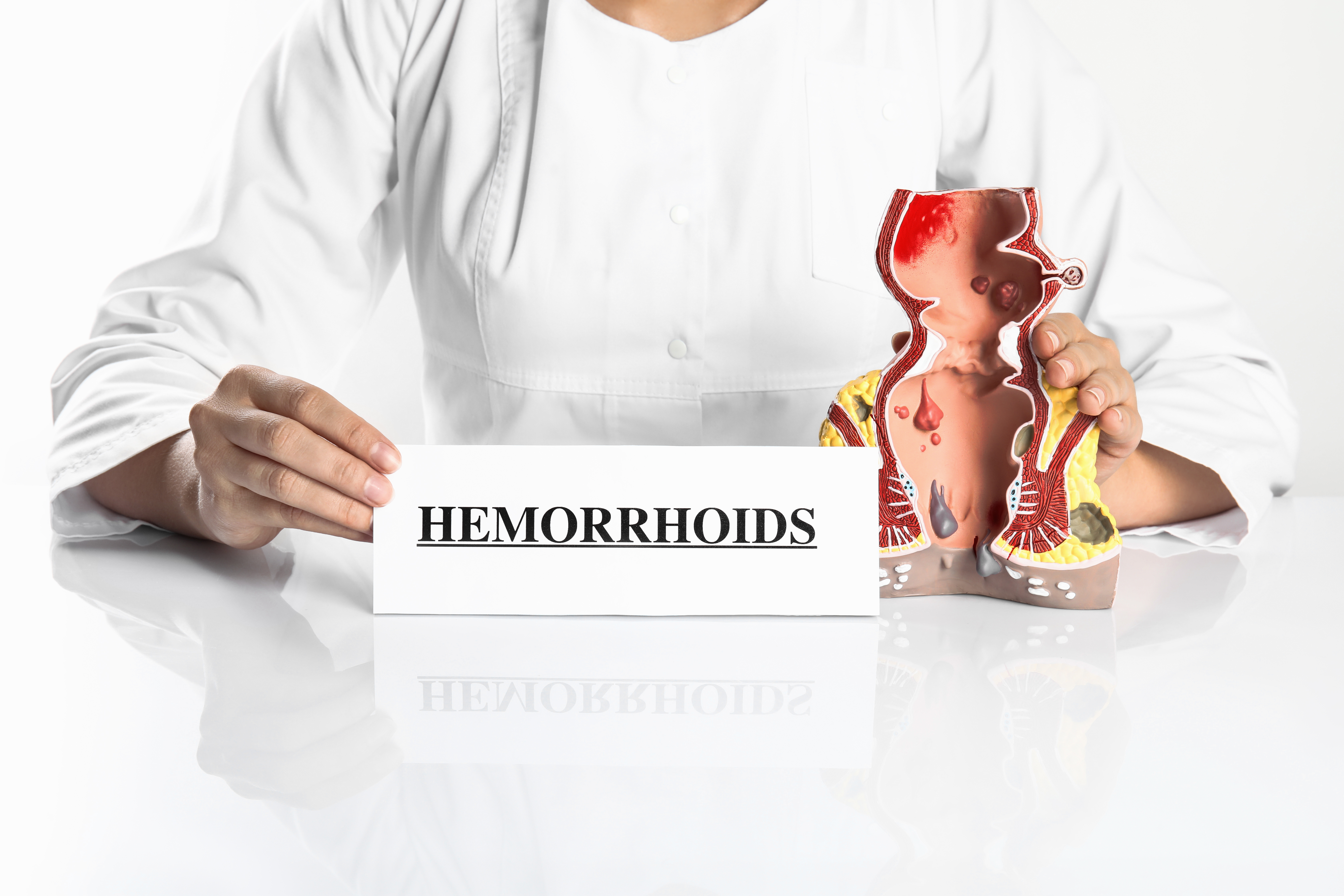 External hemorrhoids