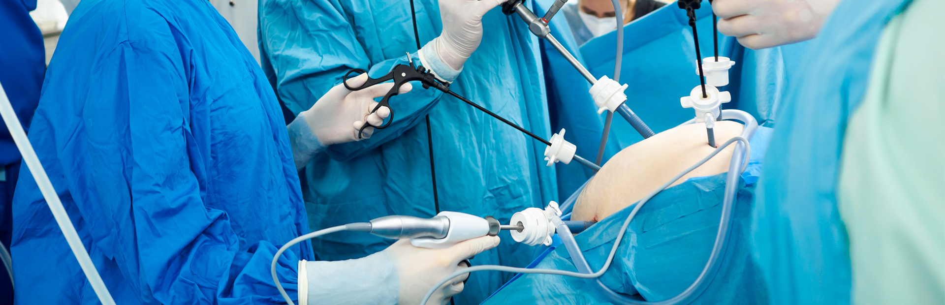 Laparoscopy vs Laparotomy