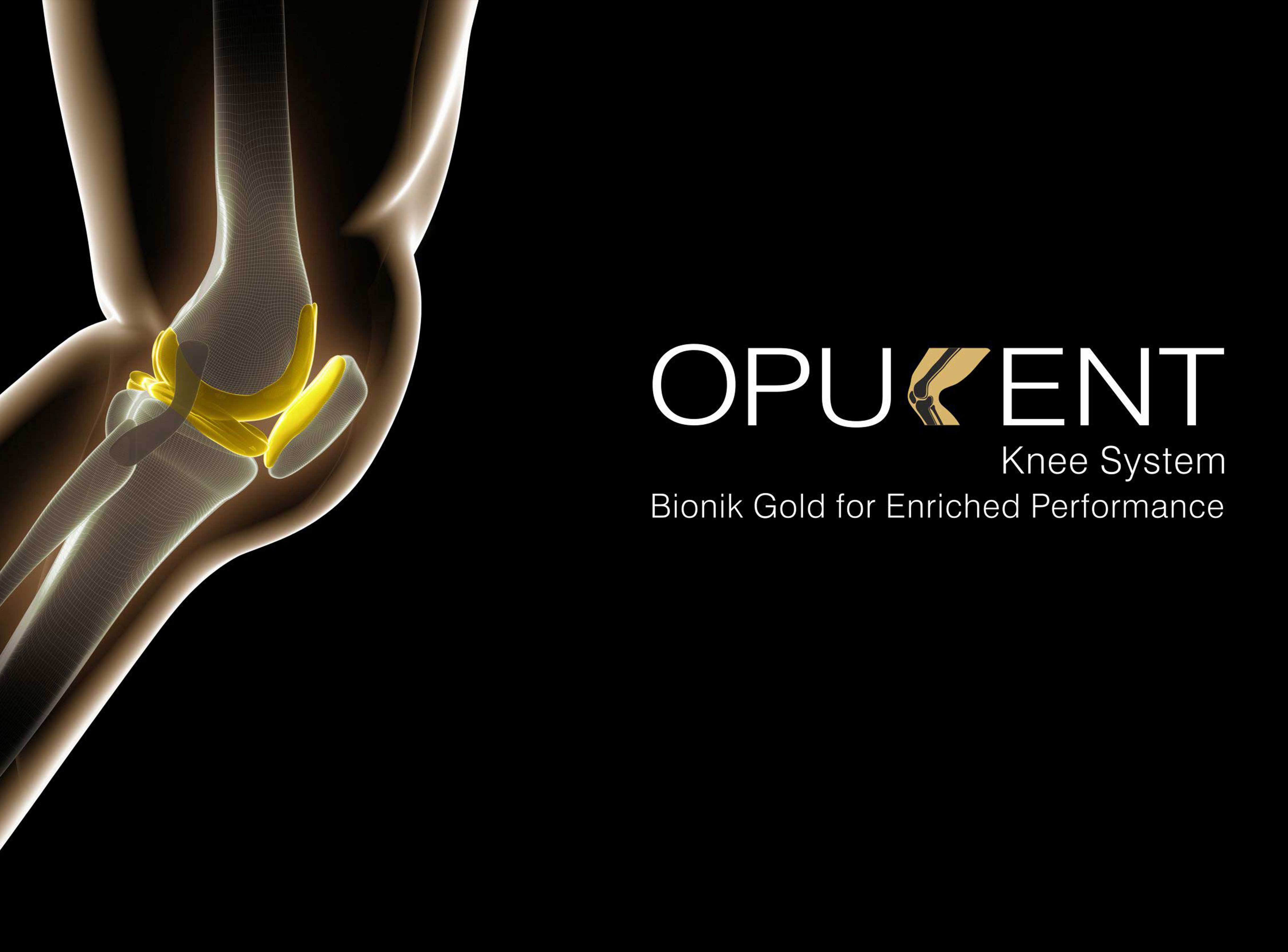 The Opulent Bionik Gold Knee: The Cutting Edge in Knee Replacement Technology