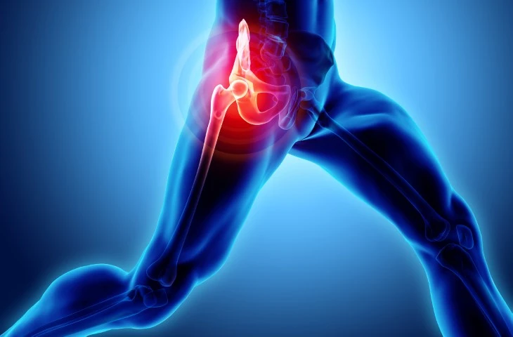 Symptoms Of Hip Osteoarthritis