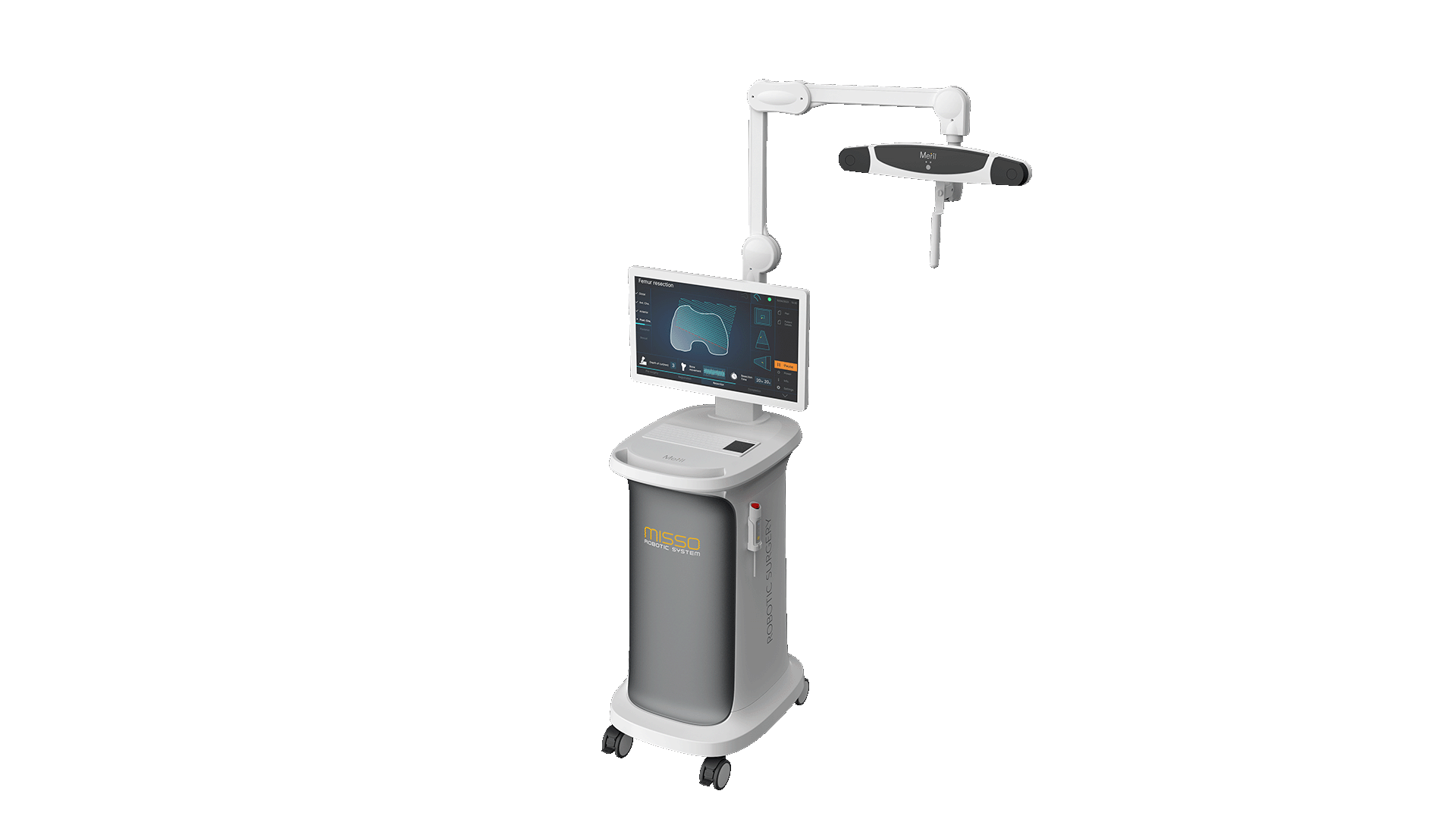 Vision cart - MISSO Robotic system - Meril